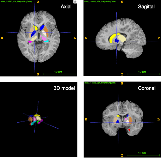 Brain subcortical areas